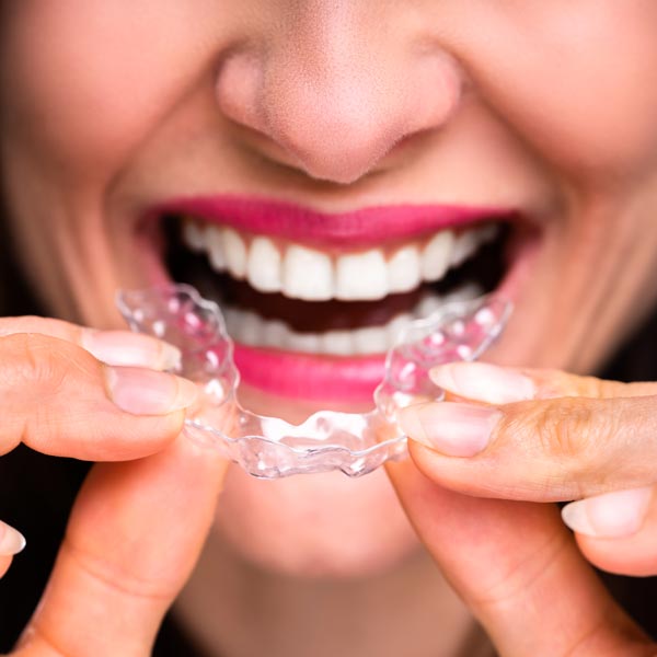 Invisalign orthodontic