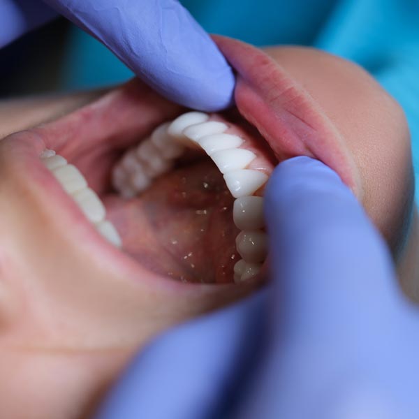 gum exam
