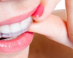 1stinsmiles-invisalign Invisalign image