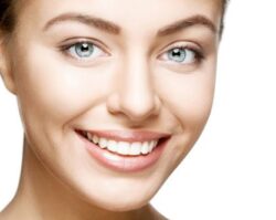Gum Reshaping 2 | 1st in Smiles - Dentist Plano, TX A women smiling