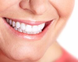 teeth_whitening